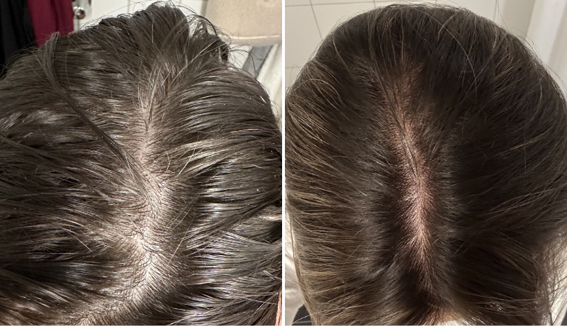 The-Every-Before-After